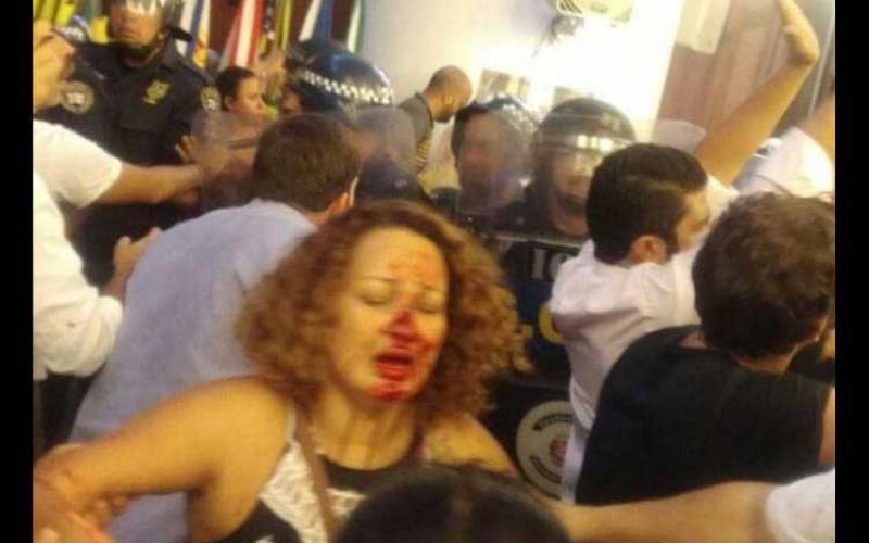 Servidores municipais foram atacados com cassetetes, spray de pimenta, bombas de gás: muitos foram feridos Foto: Divulgação